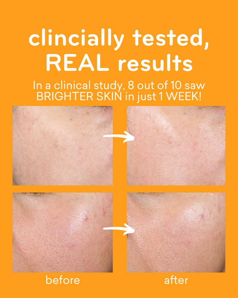 8 out of 10 users saw brighter skin in just 1 week in a clinical study.