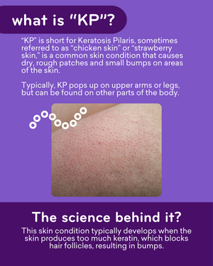 What is KP? KP is short for keratosis pilaris, sometimes referred to a chicken or strawberry skin. It's a common skin condition that causes dry, rough patches and small bumps on areas of the skin. Typically, KP pops up on upper arms or legs, but can be found on other parts of the body. KP develops when the skin products too much keratin, which blocks hair follicles, resulting in bumps.