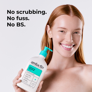 A smiling woman with red hair holds a bottle of amlactin Calm & Renew lotion against a light gray background, with the text 'No scrubbing. No fuss. No BS.'
