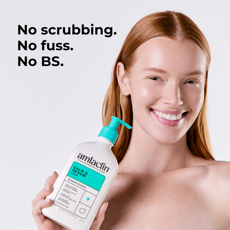 A smiling woman with red hair holds a bottle of amlactin Calm & Renew lotion against a light gray background, with the text 'No scrubbing. No fuss. No BS.'