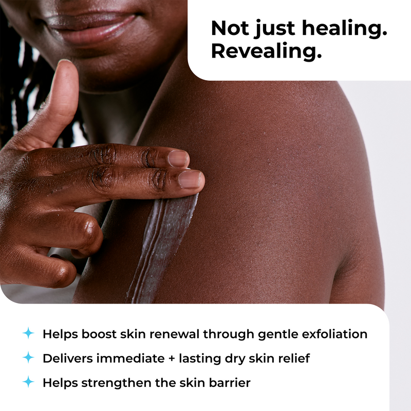 Intensive Healing Lotion with 15% Lactic Acid AHA