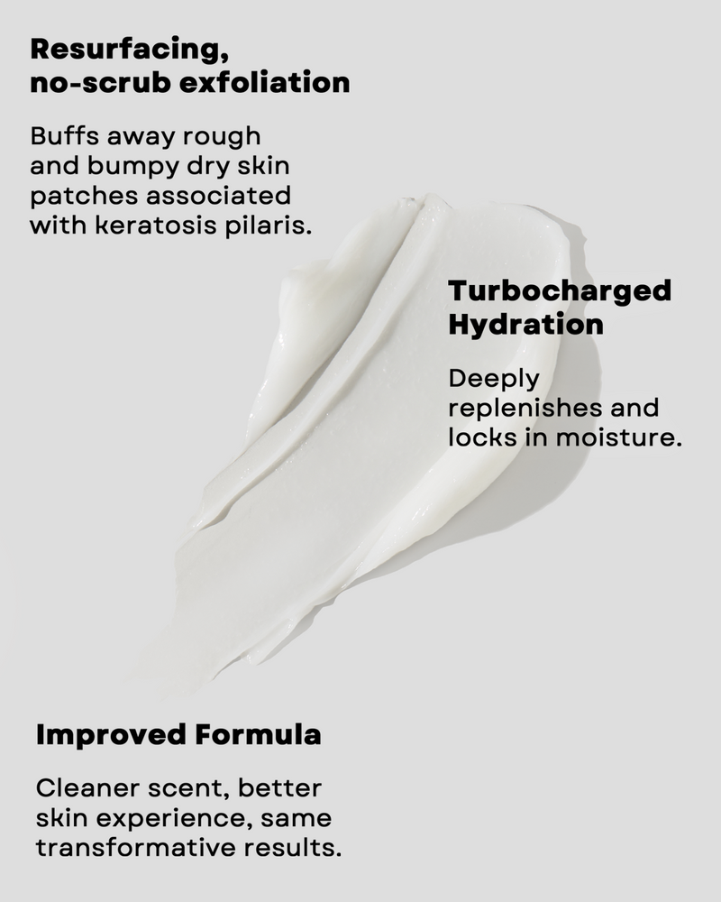 KP Bumps Be Gone Cream with 15% Lactic Acid AHA