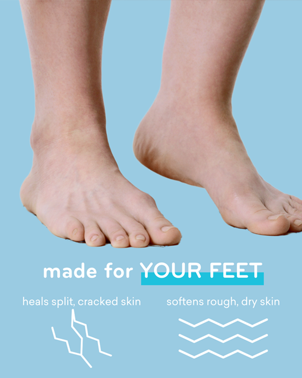 Cracked skin 2025 on feet